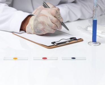 alcat testi nedir alcat testi nedir