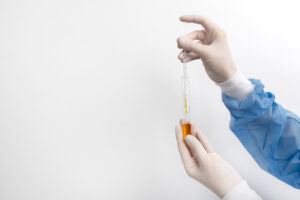 Histamin Nedir?